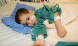 الفريق الطبي يؤكد استقرار الحالة الصحية للتوأم السيامي السوري “بسام” بعد أسبوع من عملية فصله