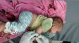 إصابة أُم وطفلَيها من جراء سقوط مقذوف حوثي على منزلهم بالجوف اليمنية